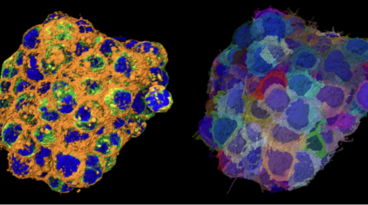 Advancing Drug Discovery by Combining Complex In-Vitro Models with AI ...