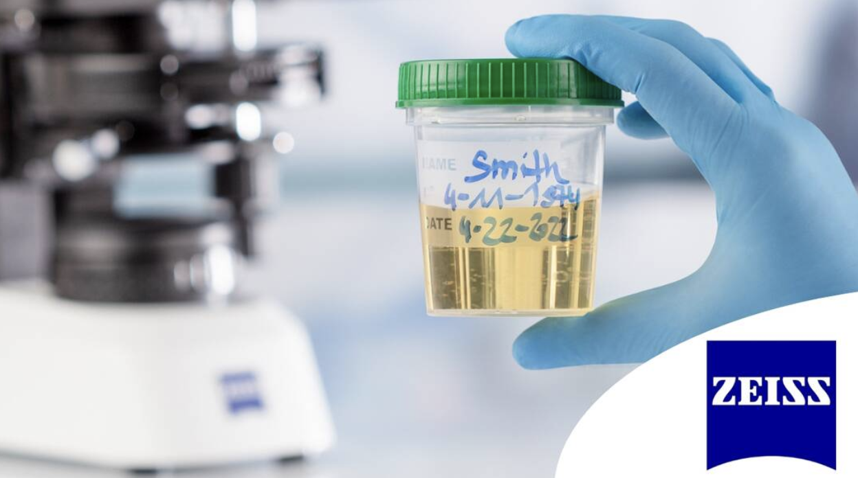 Mastering Urine Microscopy Techniques For Accurate Disease Detection