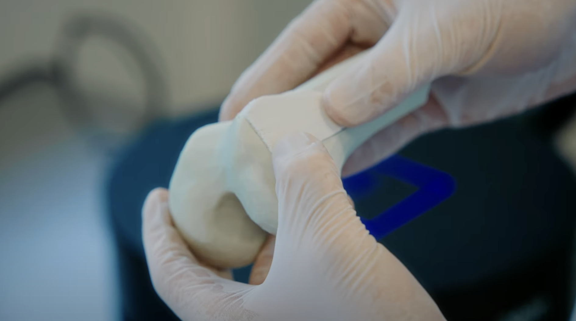 Ossiform: Quality control of 3D printed bone implants